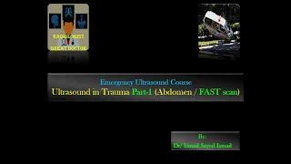 Ultrasound in Trauma Part-1 (FAST scan)