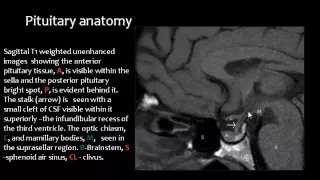 Imaging of the Sella   Dr Mamdouh Mahfouz