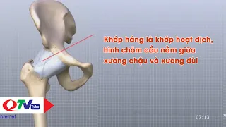 Viêm khớp háng: Nguyên nhân và cách điều trị | QTV