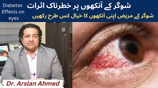 Common Eye Problems With Diabetes in Urdu Hindi | Dr. Arslan Ahmed Eye Special in Lahore Pakistan