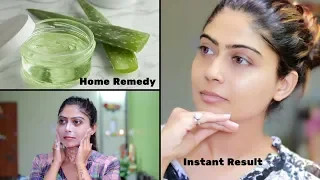 How To Do Aloe Vera Facial For Clear, Glowing And spotless Skin | Rinkal Soni