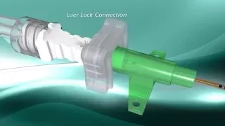 PAJUNK E Cath Product Features Animation / RichardsMedical.com