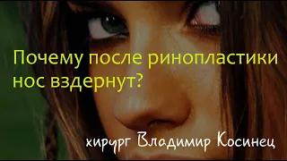 Почему после ринопластики нос вздернут? Хирург Владимир Косинец