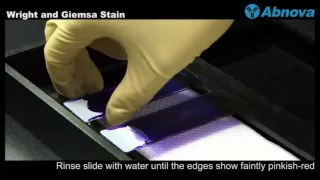 Wright and Giemsa Stain