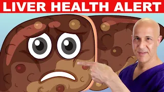 Avoid 1 Food That's Making Your LIVER Sick!  Dr. Mandell