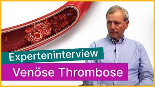 Venöse Thrombose: Entstehung und Behandlung | Asklepios