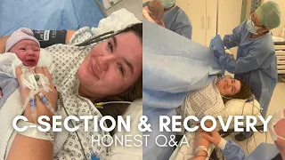 HONEST C-SECTION AND RECOVERY Q&A | My positive experience, emergency c-section, recovery tips