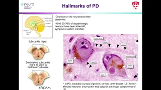 Modelling disorders of the brain through patient-derived stem cells