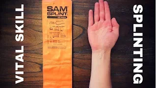 Fundamentals of Splinting