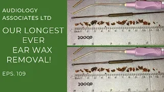 OUR LONGEST EAR WAX REMOVAL YET! - EP 109