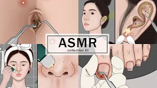 ASMR 바디 트리트먼트! 배꼽 돌 제거, 자란 발톱, 귀 청소, 여드름 | Meng's Stop Motion