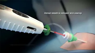 How to use EXOSEAL™ Vascular Closure Device