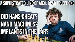 Did Hans Niemann Cheat? - Conspiracy Theory's and Chess Drama (Full Breakdown)