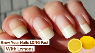 How To Grow Your Nails LONG Fast With Lemons! Home remedies for nail growth || nails grow faster ||