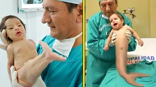 Unusual Kids Born with Unbelievable Medical Conditions