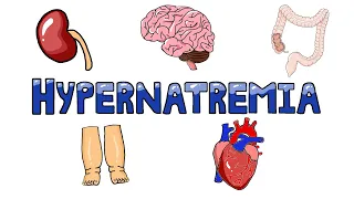 An Approach to Hypernatremia - Hypernatremia Diagnostic Algorithm | Hypernatremia Causes MADE EASY