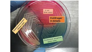 CLED agar Introduction ,composition, preparation, colony characteristics and modification