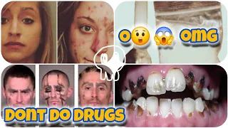 { Part 3}What Happens To Your Body If You Do Meth and Other Drugs