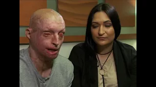 UK Acid Attack Victim Speaks Out