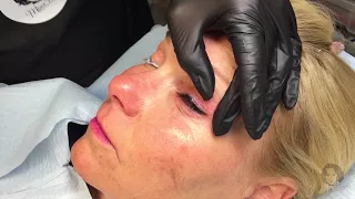 Permanent Makeup Eyeliner Procedure and Camouflage Demonstration