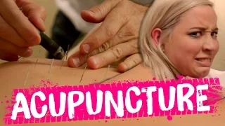 Acupuncture MIRACLE?! (Beauty Trippin)