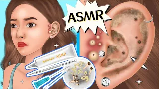 ASMR animation｜removal of acne blackheads and sebaceous cysts for girls listening to music