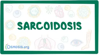 Sarcoidosis - causes, symptoms, diagnosis, treatment, pathology