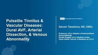Pulsatile Tinnitus & Vascular Diseases | Satoshi Tateshima, MD, DMSc | UCLA Health