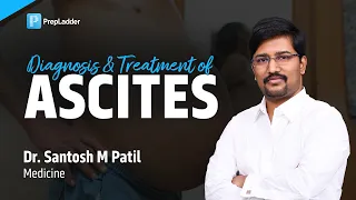 Diagnosis & Treatment of Ascites by Dr. Santosh M Patil