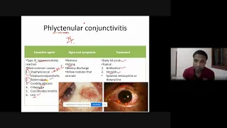 Diseases of conjunctiva ,sclera a