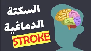 STROKE - How to detect it Early? السكتة الدماغية