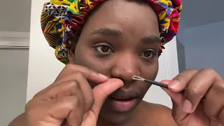 HOW TO REMOVE WHITEHEADS and BLACKHEADS