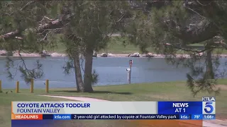 2-year-old girl attacked by coyote at Fountain Valley park