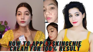 SECRET To Get Brighter Skin Naturally in 2 Weeks | No side effects | 100% result