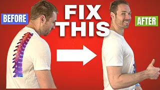 How to Fix Your Posture (INSTANT CHANGES!)