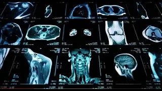 Augmenting Radiology with AI