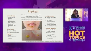 Infecciones de piel y tejidos - Clevy Perez