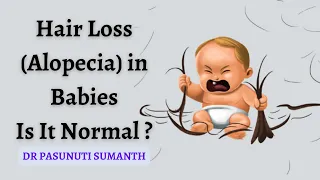 Hair Loss (Alopecia) in Babies - DR Pasunuti Sumanth