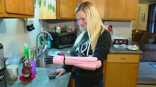 Hero Arm arrives to local woman born without left hand