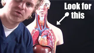 Pneumothorax for Nursing(collapsed lung) Animation, Treatment, Decompression, Pathophysiology