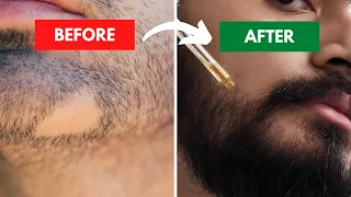 How to grow a Beard | Evidence Based Beard Growth, Care and Treatments