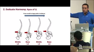 Sagittal Balance and Parameters - David O. Okonkwo, MD, PhD