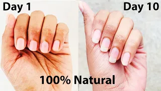 NAIL GROWTH at Home | Grow Nails in 10 Days | Nail growth Fast | Nail Growth Oil