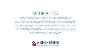 Мини-гастрошунтирование