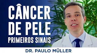 Câncer de Pele, Primeiros Sinais – Dr. Paulo Müller Dermatologista.