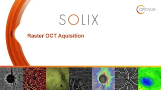 Solix Raster Acquisition