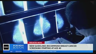 Breast cancer screenings should start at age 40, new guidelines suggest