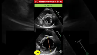 2-D Measurements in Echo