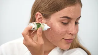 STOP акне и другим проблемам кожи лица! Линейка Acne-Off от MyIDi