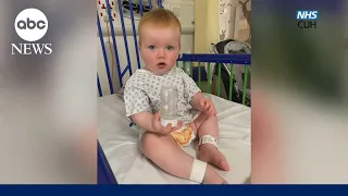 Breakthrough helps deaf baby hear for the first time